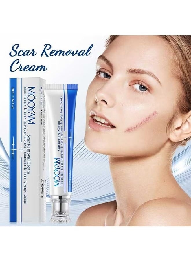 MOOYAM Scar Removal Cream, Skin Repairing Cream Fade Scars/Stretch Marks/Acne Treatment, Improve Scar Skin, Deeply Moisturizes Skin - Image 2