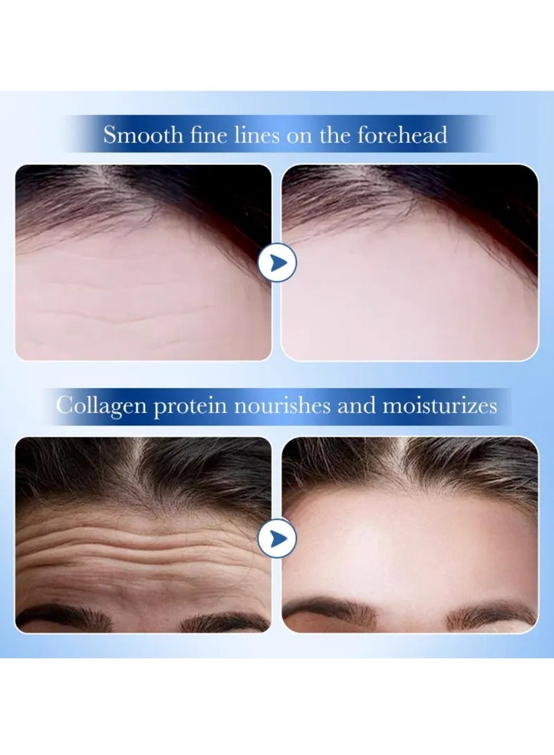 SADOER 10 Pcs Collagen Hyaluronic Acid Forehead Patch Set Smooth Anti Wrinkle Hydrating Nourishing Skin Friendly Hydrogel High Moisturizing Collagen Forehead Patch Reduce Fine Lines Skin Firming Forehead Patches - Image 5