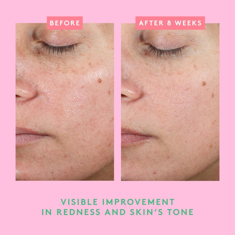 Drunk Elephant Bora Barrier Repair Cream - 50 ml/1.69 fl oz - Ultra-Rich Moisturizer - Clean Clinical Skincare - Cruelty-Free - Dermatologist-Tested - Free of Essential Oils, Silicones, and Fragrance - Image 5