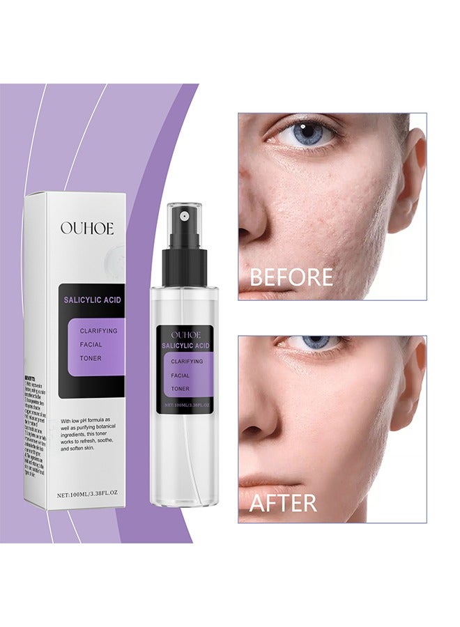 أوهو حمض الساليسيليك لتنقية تونر الوجه - حمض الساليسيليك يتحكم في زيت علاج حب الشباب ، مضاد لحب الشباب مقشر لطيف ، يعزز تجديد خلايا البشرة ، البشرة الحساسة 100 مل - Image 1