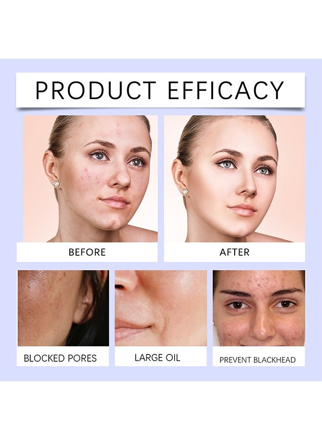 أوهو حمض الساليسيليك لتنقية تونر الوجه - حمض الساليسيليك يتحكم في زيت علاج حب الشباب ، مضاد لحب الشباب مقشر لطيف ، يعزز تجديد خلايا البشرة ، البشرة الحساسة 100 مل - Image 4