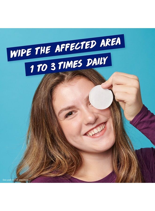 Clearasil أقراص غسول الوجه لعلاج حب الشباب 5 في 1، 90 قطعة (عبوة من 2) - Image 4