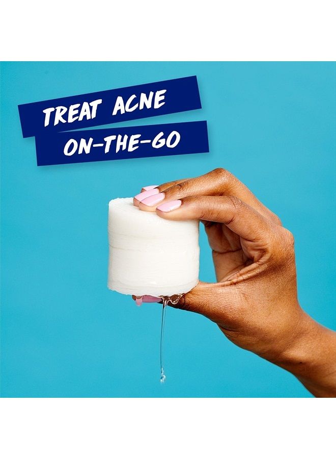 Clearasil أقراص غسول الوجه لعلاج حب الشباب 5 في 1، 90 قطعة (عبوة من 2) - Image 5