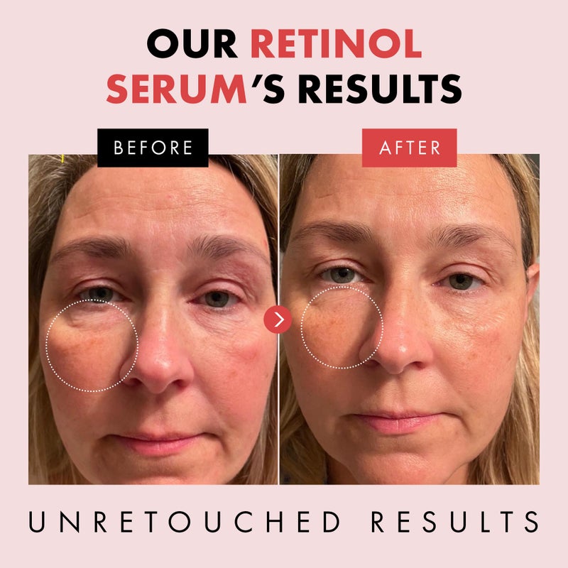 Eclat Skincare Renewing Retinol Serum for Face - Anti Aging Serum with Hyaluronic Acid & Aloe Vera - Hydrates and Improves the Signs of Aging (Fine Lines, Wrinkles & Dark Spots) 1 Fl Oz - Image 3