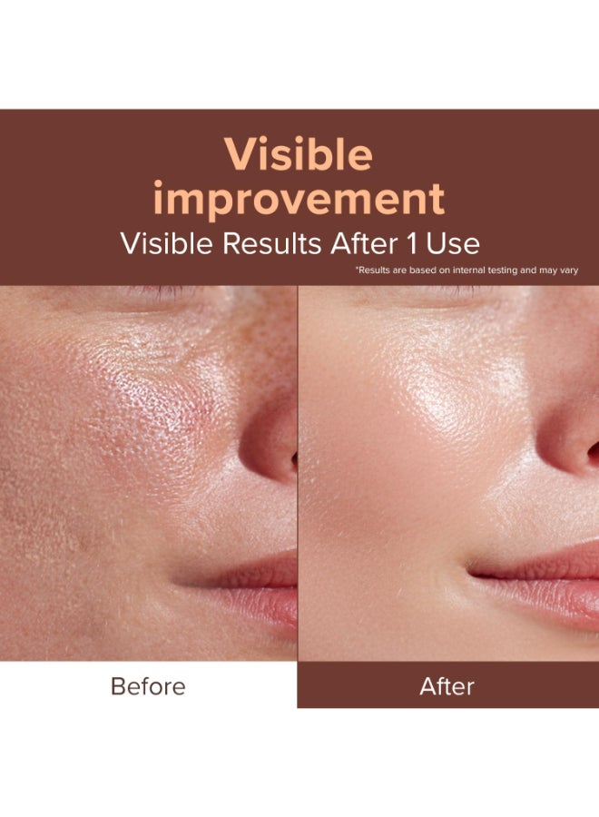 ID PLACOSMETICS idplacosmetics EXOV BoAmpoule 101 floz 30ml Exosome Serum 720000 PPM with PDRN Glutathione Korean Skincare Microneedling Serum for SmootherLooking Texture Elasticity Support - Image 4