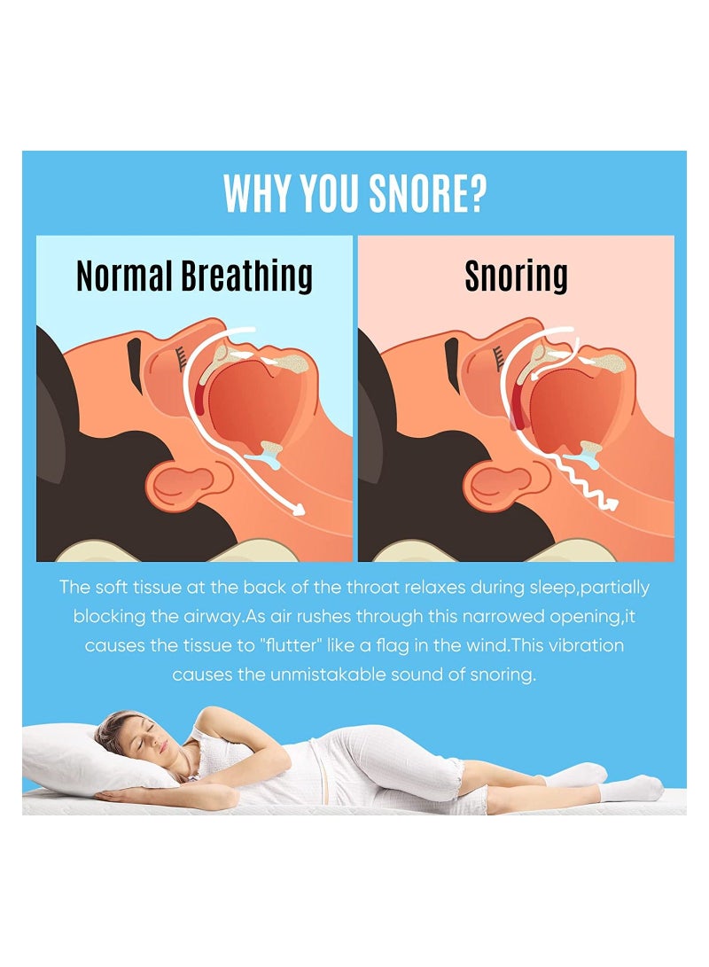 NNEWVANTE Anti-snoring Mask, anti-snoring device to help stop snoring, snoring reduction solution, comfortable and adjustable for men/women. Give people a good night's sleep  - Image 3