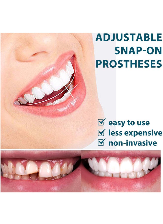 EELHOE Adjustable Snap-On Prosthese, Cosmetic Denture Veneers For Upper And Lower Jaw, Denture Smile Teeth Customizable Temporary Perfect Fake Teeth Molds Braces For Snap In Instant And Confidence Smile  - Image 5