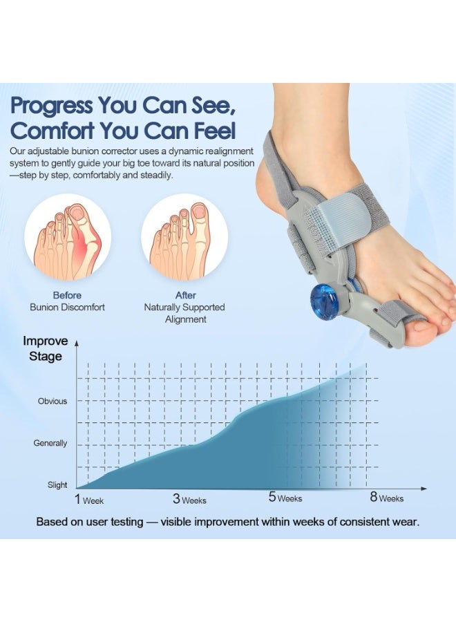 Adjustable Knob Bunion Corrector for Women and Men - Orthopedic Relief with Silicone Pad - Strong Bunion Fix for Left and Right Feet - Image 3