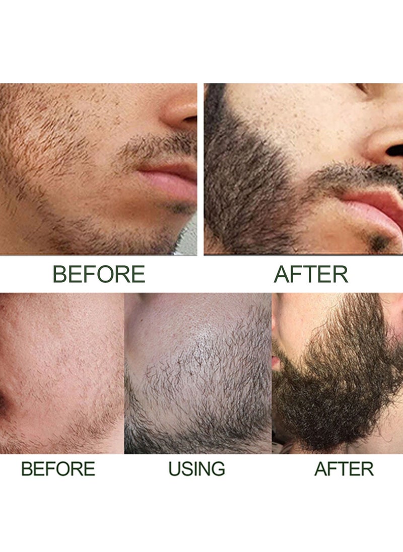 Men's Beard Thickening Care Set, Serum and Roller for Better Results