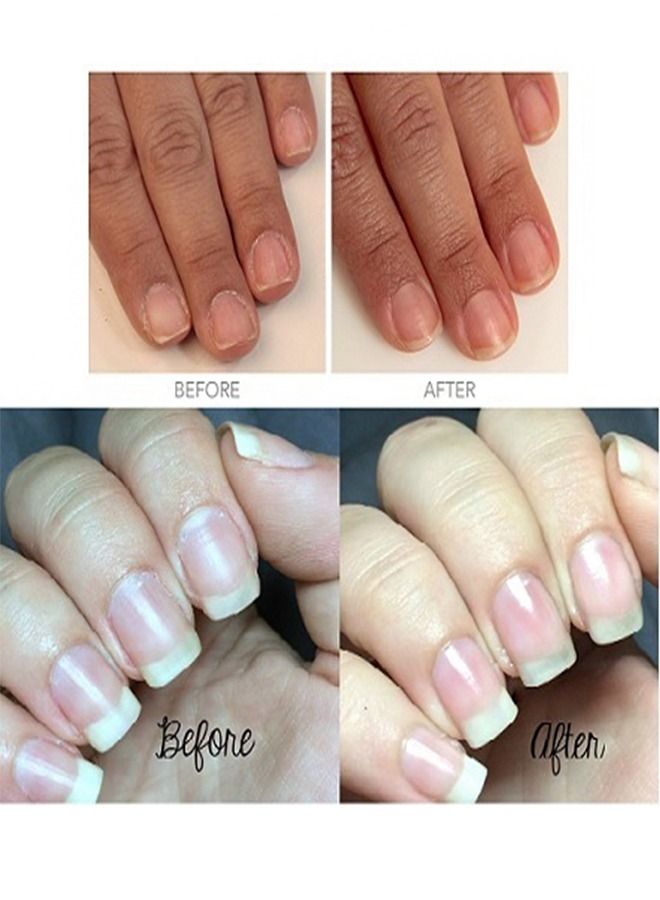 CND Cuticle Eraser Gentle Exfoliator Treatment 15 ml - Image 5