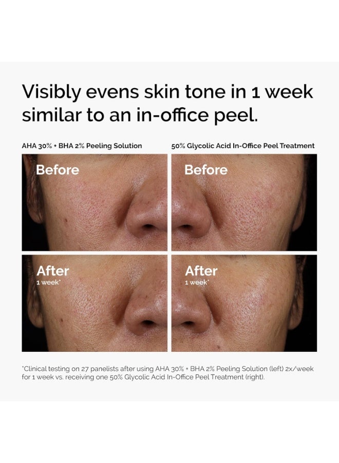 AHA 30% + BHA 2% Peeling Solution, Advanced Exfoliating Peel for Brighter Skin 30ml - Image 2