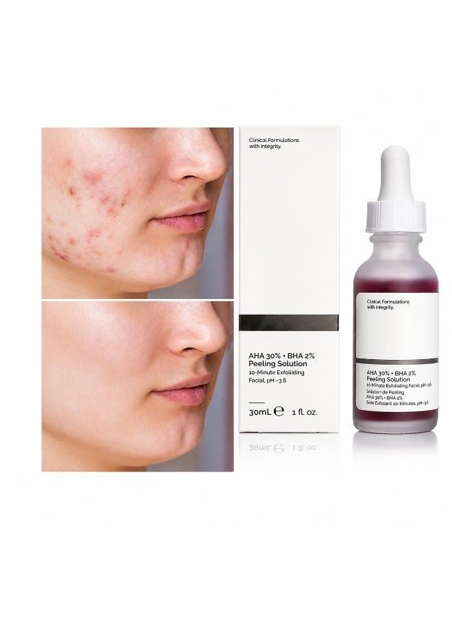 AHA 30% + BHA 2% Peeling Solution, Advanced Exfoliating Peel for Brighter Skin 30ml - Image 1