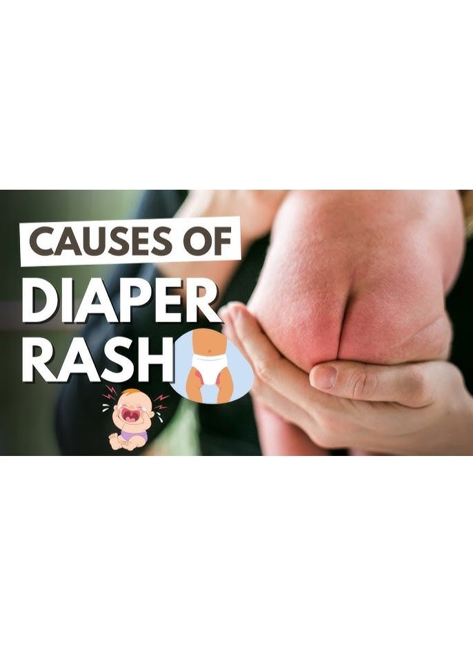 VADERM Baby Diaper Rash Cream – Fragrance Free, Suitable for Sensitive Skin, 250g - Image 4