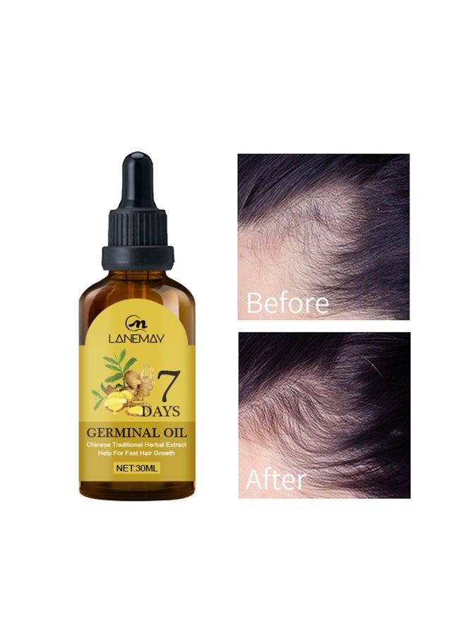 LANEMAY Ginger Hair Growth Serum, Ginger Hair Growth Liquid, Ginger Hair Growth Oil, Ginger Hair Growth Oil, Ginger Essential Hair Oil, Anti Hair Loss Ginger Serum, Hair Repair Ginger Serums, 30 ml - Image 2