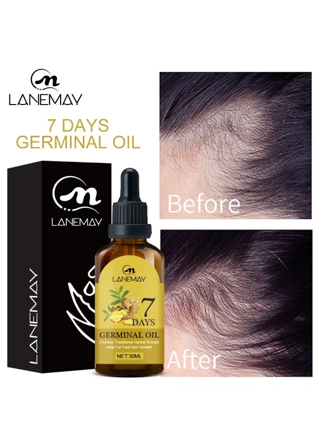 LANEMAY Ginger Hair Growth Serum, Ginger Hair Growth Liquid, Ginger Hair Growth Oil, Ginger Hair Growth Oil, Ginger Essential Hair Oil, Anti Hair Loss Ginger Serum, Hair Repair Ginger Serums, 30 ml - Image 1