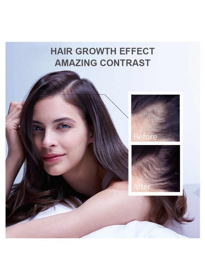 LANEMAY Ginger Hair Growth Serum, Ginger Hair Growth Liquid, Ginger Hair Growth Oil, Ginger Hair Growth Oil, Ginger Essential Hair Oil, Anti Hair Loss Ginger Serum, Hair Repair Ginger Serums, 30 ml - Image 5