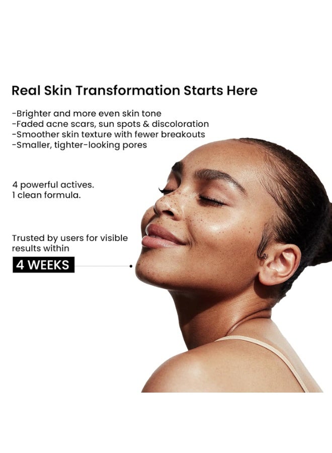 WILD OAK 2% Alpha Arbutin + 10% Niacinamide Face Serum | Alpha Arbutin Is Powerful For Pigmentation, Acne Scars & Spot | Niacinamide - Minimises Pores, Hydrates & Reduce Wrinkles & Fine Lines | 30Ml - Image 2