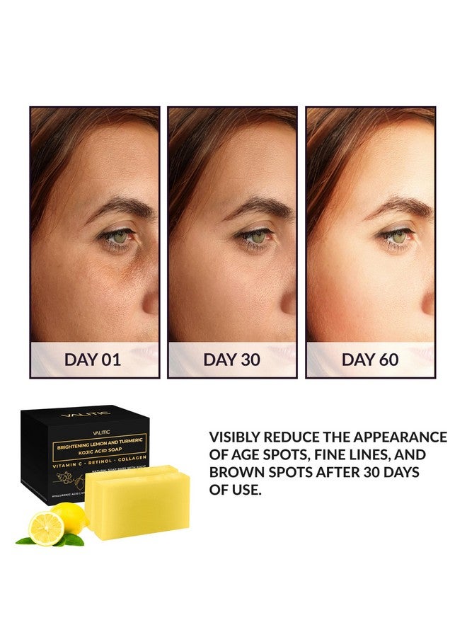Brightening Lemon & Turmeric Kojic Acid Soap With Vitamin C, Retinol, Collagen - Original Japanese Complex Infused With Hyaluronic Acid, Vitamin E, Shea Butter, Castile Olive Oil (2 Pack)