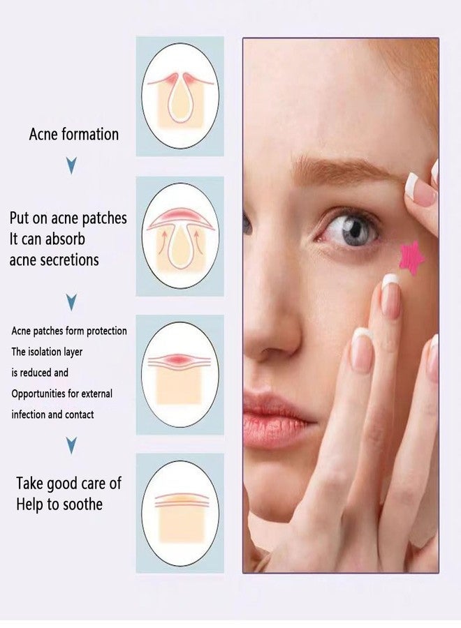 VibeSeal Star Pimple Patches for Face w/Hydrocolloid, Salicylic Acid &Tea essential oil 240 Patches, Hydrocolloid Acne Patch,-03 - Image 4