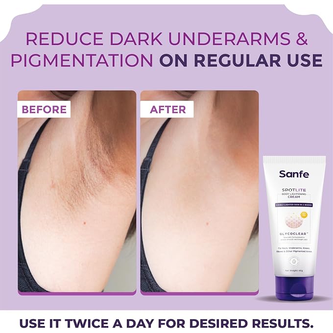 Sanfe Spotlite Body Cream For Dark Neck, Joints and Skinfolds | Enriched with 3% Glyoclic Acid, Alpha Arbutin & SPF 30 | For Dark Patches, Detanning, Anti Aging and Skin Tightening | Helps in - Image 3