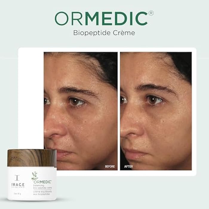IMAGE Skincare, ORMEDIC Biopeptide Crème, Balancing Face Moisturizer with Shea Butter, Hyaluronic Acid and Organic Plant Oils, 2oz - Image 3