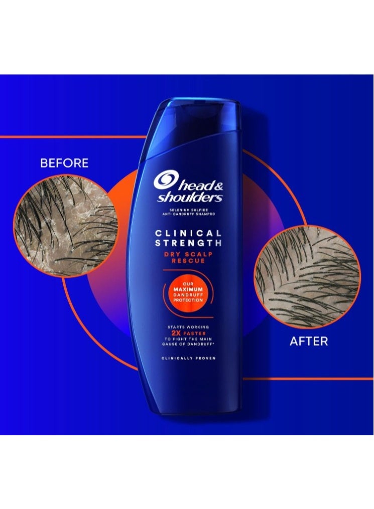 Head & Shoulders Clinical Strength Anti Dandruff Shampoo for Severe Dandruff & Dry Scalp With 1% Selenium Sulfide 400ml - Image 4