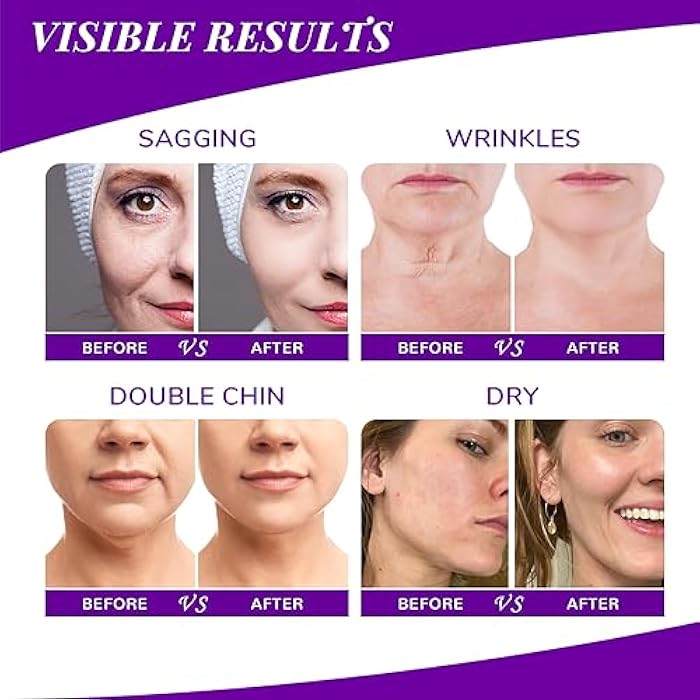 ANAI RUI Neck Firming Cream - Skin Tightening Cream for Neck 1.7 Oz - Image 5