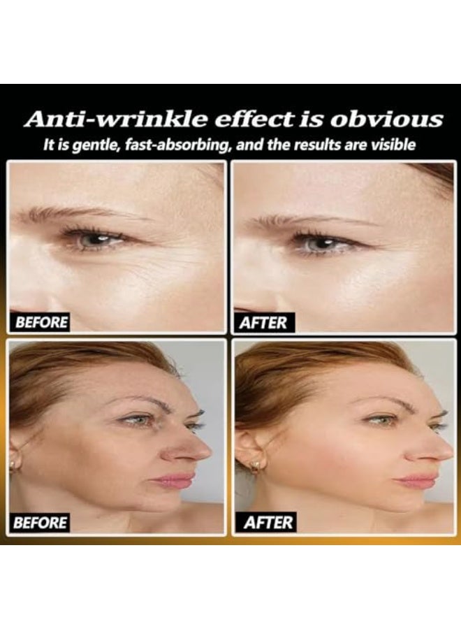QINGLING Polypeptide Tightening And Anti -Wrinkle Cream,Wrinkle Removal Cream,  Anti Aging Moisturizer for Firming Face 50g (1pcs) - Image 5