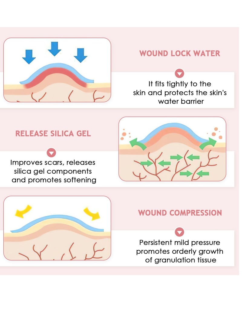 Excefore Silicone Scar Sheets, Silicone Scar Tape Roll, 8 Pack Scar Removal Gel Patches, Easy-Tear Gel Tape For Scar, Soft Silicone Scar for Surgery Scars, Medical Silicone Scar Repair Sheets - Image 3