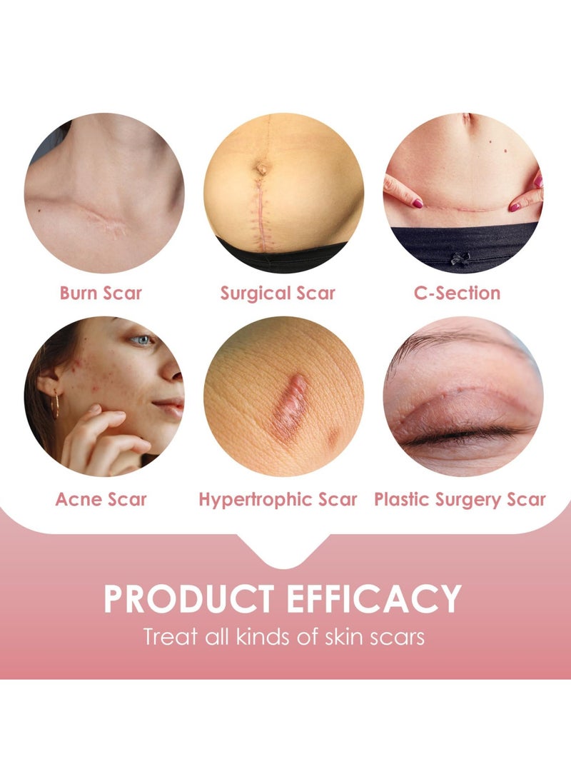 Excefore Silicone Scar Sheets, Silicone Scar Tape Roll, 8 Pack Scar Removal Gel Patches, Easy-Tear Gel Tape For Scar, Soft Silicone Scar for Surgery Scars, Medical Silicone Scar Repair Sheets - Image 5