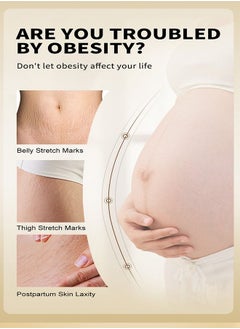 OEDO Rose Stretchmarks Cream 40g Maternity Skin Treatment Pregnancy Scars Repair, Can Promote Cell Regeneration, Repair Necrotic Cells and Enhance Skin Elasticity, Designed For Mother's Stretch Marks  - Image 4