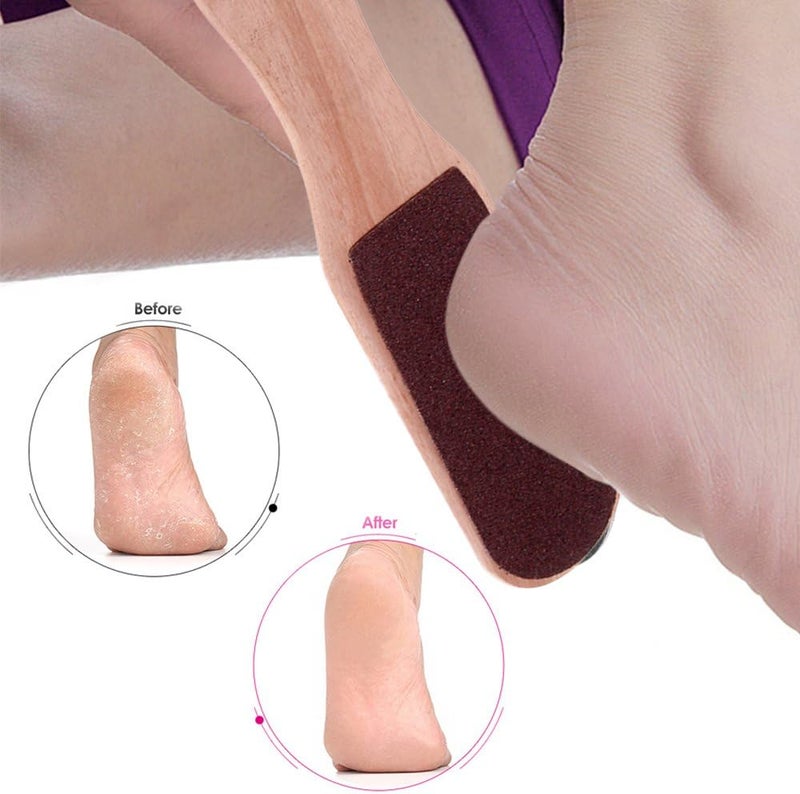 Anself Double Sided Foot Rasp Manicure File Callus Remover Pedicure Tool - Image 3