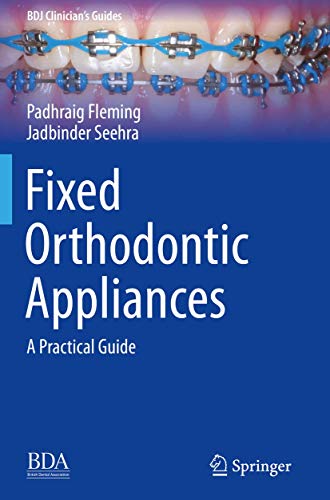 Fixed Orthodontic Appliances: A Practical Guide - Image 4