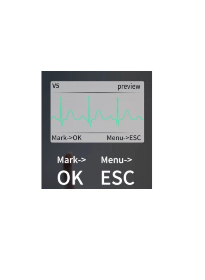 CONTEC نظام ECG الديناميكي CONTEC TLC5000 - Image 5