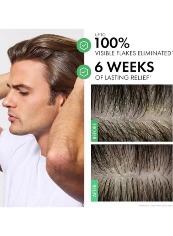 Dercos (Anti Dandruff DS) Anti-Dandruff Treatment Shampoo for Sensitive Scalp 390ml – Hydration & Relief - Image 2