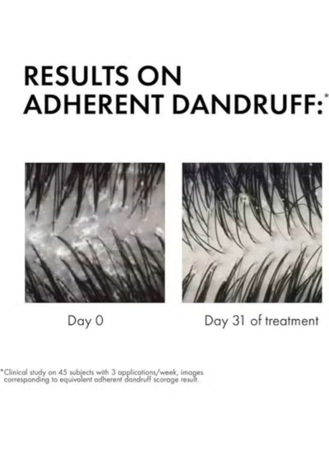 Dercos (Anti Dandruff DS) Anti-Dandruff Treatment Shampoo for Sensitive Scalp 390ml – Hydration & Relief - Image 4