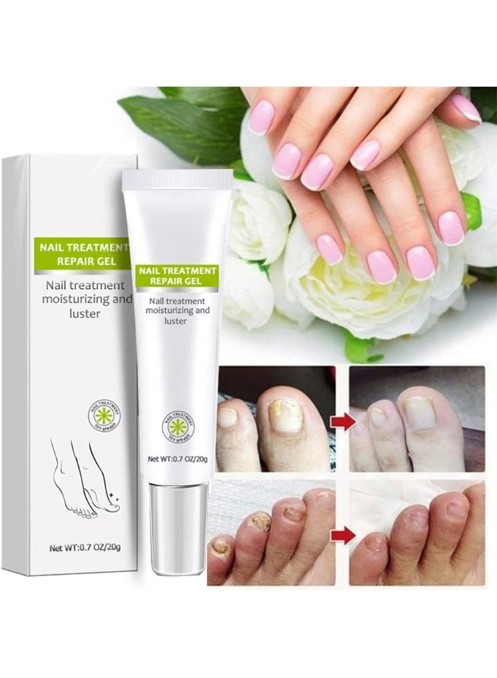 EELHOE Nail Repair Gel Hand And Foot Onychomycosis Repair Soft Nail Thickening To Remove Onychomycosis Bright Nail Repair - Image 4