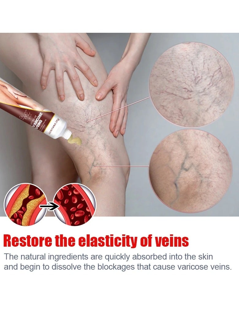 KanyeHB Varicose Veins Remove Cream, Blood Circulation Vein Care Leg Cream, Vasculitis Phlebitis Foot Care Ointment, Pain Relief Therapy Firming Vein Lotion For Treatment Of Varicose Veins - Image 2