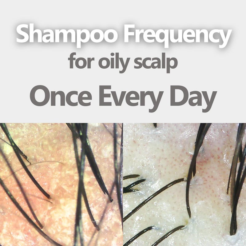 Aromase Oily Scalp Balancing Shampoo (Ideal for oily scalp with dandruff) 14 FL OZ - Image 5