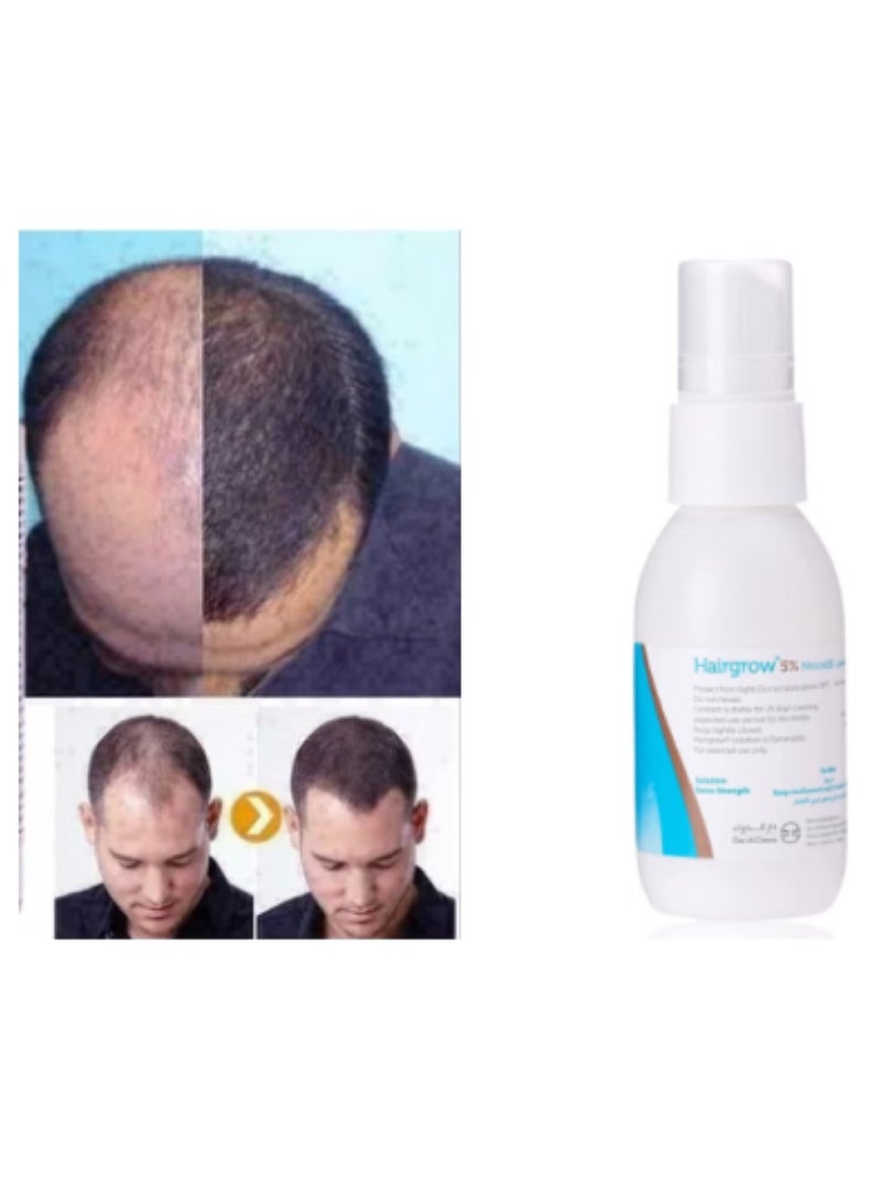 Dar Al Dawa Minoxidil 5% Solution Hair Regrowth Tonic 50ml (5 Pack 5 Month) - Image 2
