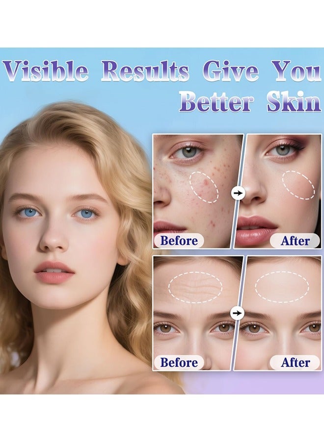 140 أداة تيتانيوم صغيرة الإبر لرعاية الجلد، ختم ميكرونيدل، أداة مهنية ميكرونيدلنغ للشعر، اللحية، اسطوانة ميكرونيدلنغ للرجال والنساء - Image 3