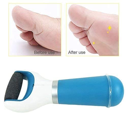 LIPSA ENTERPRISE Lipsa Enterprise Foot Scrubber for Dead Skin Tools for Feet Foot Scrubber for Women Callus Remover for Feet Electronic Smooth and Soft Feet Scrubber Cracked Heels Remover  - Image 5