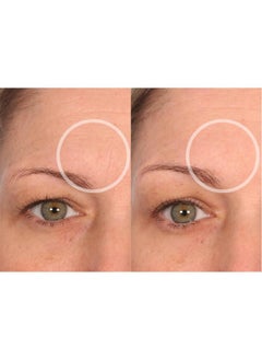 Sio SiO Beauty Mid-Brow Forehead Anti-Wrinkle Patch - Rapid Overnight Reusable Silicone Patch to Reduce Furrows, Expression Lines, and the 11s  - Image 3