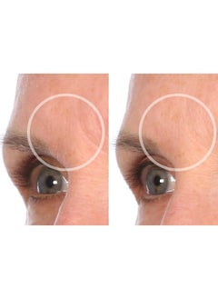 Sio SiO Beauty Mid-Brow Forehead Anti-Wrinkle Patch - Rapid Overnight Reusable Silicone Patch to Reduce Furrows, Expression Lines, and the 11s  - Image 5