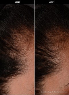 سيفورا مجموعة سيفورا لتعزيز كثافة الشعر - سيروم للشعر وفروة الرأس مع البيوتين والببتيدات لشعر أكثر كثافة وكثافة (50 مل)  - Image 3