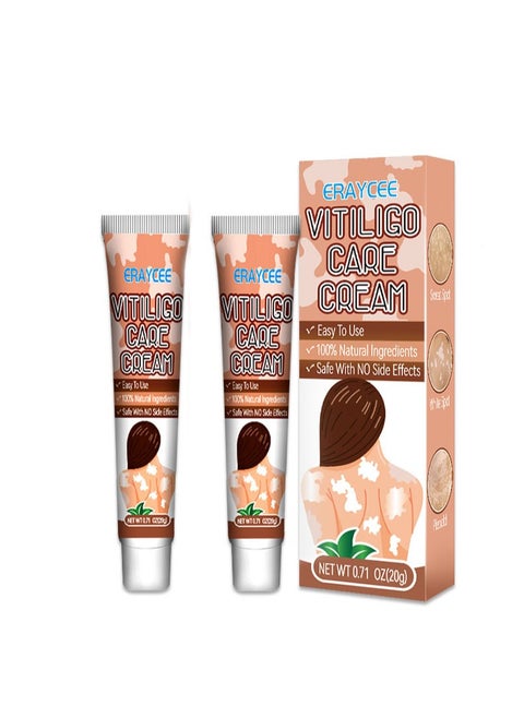 2 Pieces Vitiligo Care Cream，Vitiligo Treatment, Improve Skin Pigmentation, Reduce White Spots
