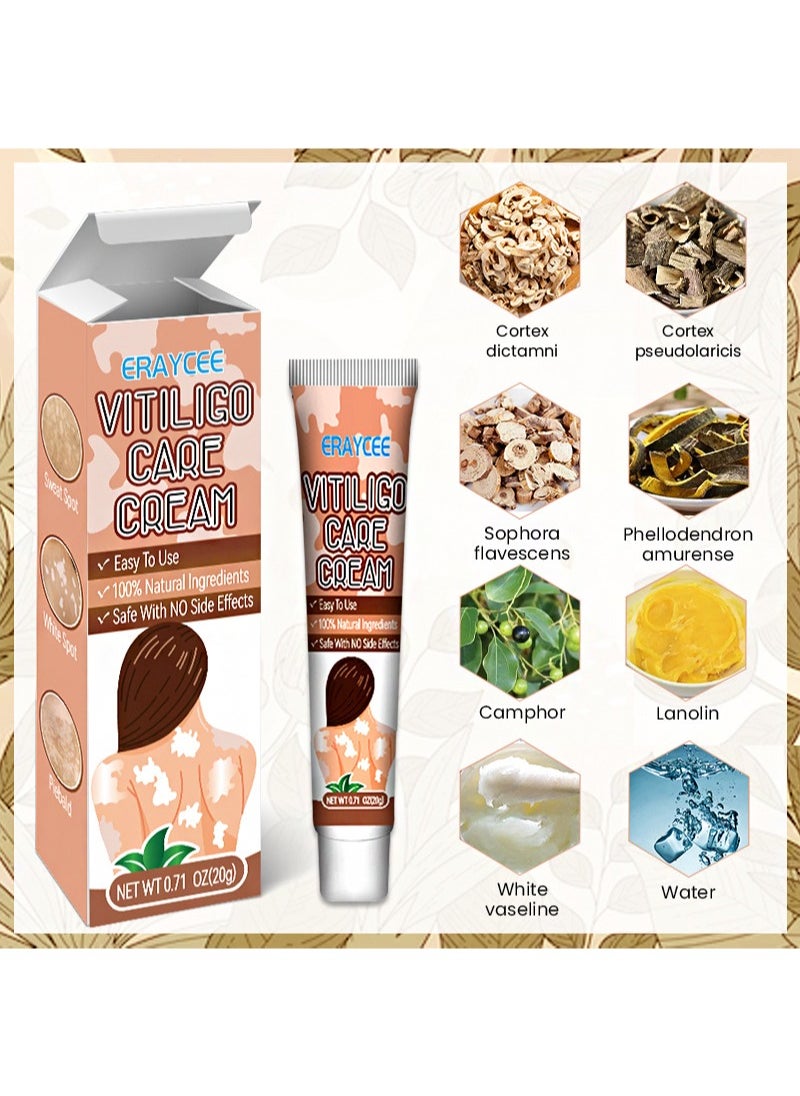 2 Pieces Vitiligo Care Cream，Vitiligo Treatment, Improve Skin Pigmentation, Reduce White Spots