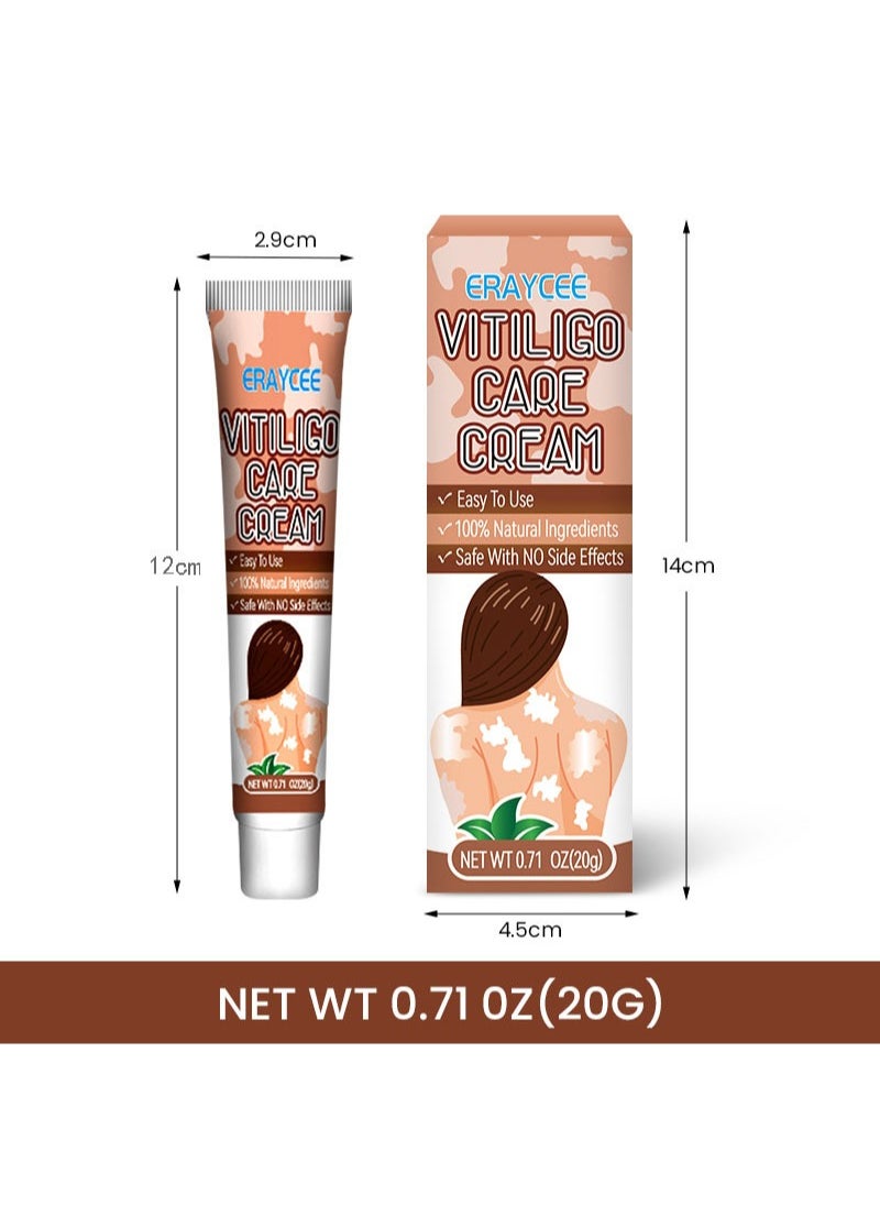 2 Pieces Vitiligo Care Cream，Vitiligo Treatment, Improve Skin Pigmentation, Reduce White Spots