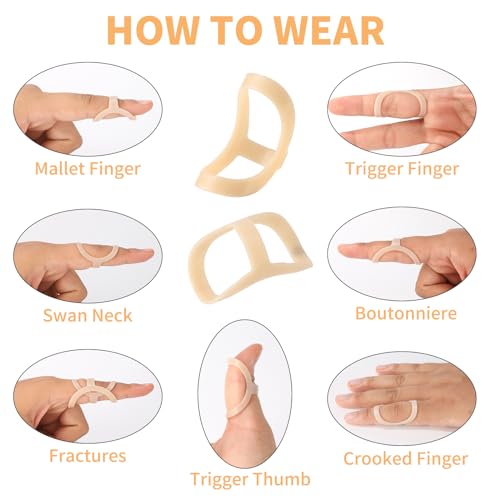 CAGSIG Oval Finger Splints, 5PCS Oval Trigger Finger Splint for Trigger/Mallet/Arthritis/Straightening, Trigger Finger Brace for Thumb Middle Pinky or Ring Finger -Size 6,7,8,9,10 - Image 3