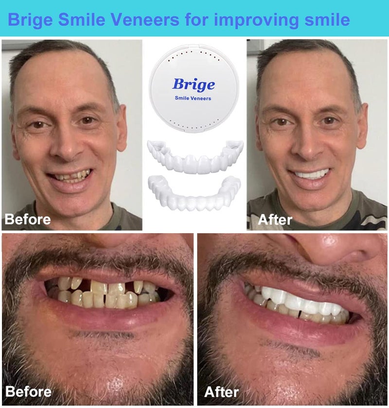 Brige Smile Teeth Denture Temporary False Teeth Improve Smile - Image 2